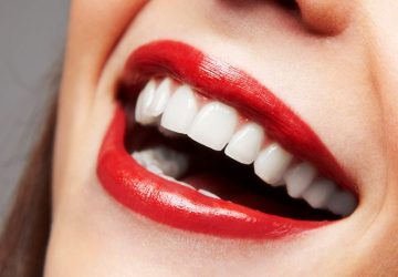 Improving Your Smile with Cosmetic Dental Veneers